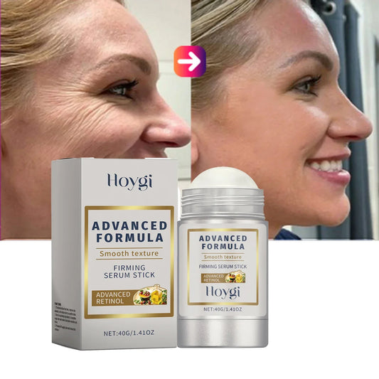 Retinol & Hyaluronsäure Anti-Falten Stick von Tradeliana